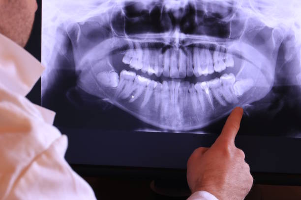 Best Broken or Cracked Tooth Emergency Dentist in Wyandotte, MI