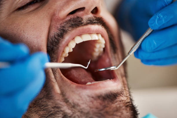 Best Orthodontic Emergency Dentist in Wyandotte, MI