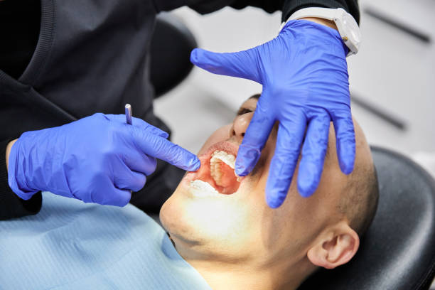 Best Emergency Dentist for Lost Fillings or Crowns in Wyandotte, MI
