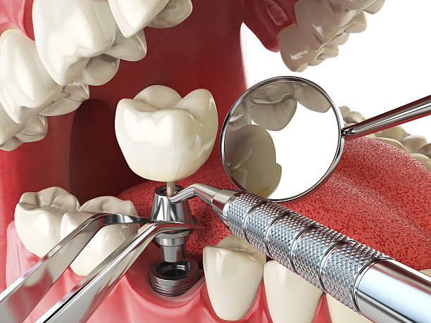 Best Emergency Root Canal Treatment in Wyandotte, MI