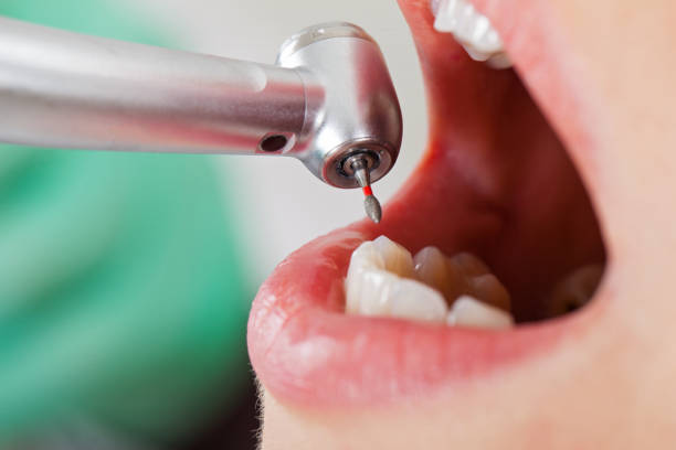 Best Emergency Dental Extractions in Wyandotte, MI